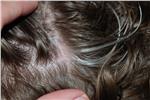 Tips for Reducing and Preventing White Hair