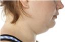 Face Exercises To Lose Neck Fat