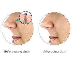 How To Get Rid Of Blackheads On Nose